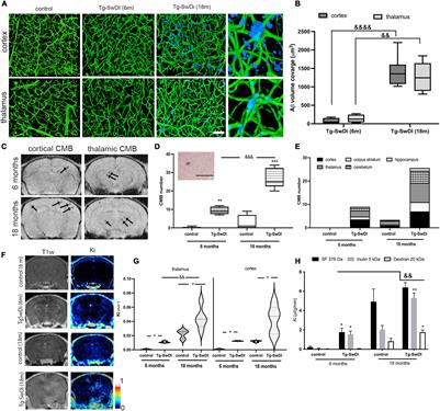 Frontiers | Transcriptomic Profile Of Blood–Brain Barrier Remodeling In ...